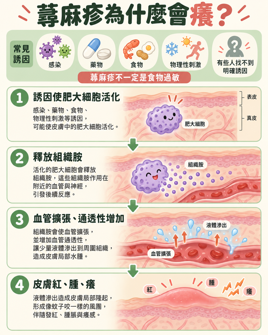 蕁麻疹從誘因、肥大細胞活化、組織胺釋放到皮膚紅腫搔癢的機轉圖解